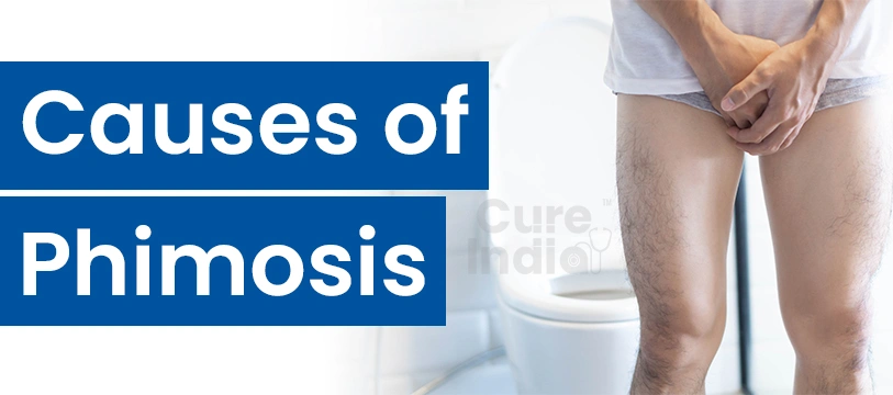 Causes of Phimosis Surgery